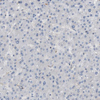 Immunohistochemical staining of human liver shows no positivity in hepatocytes.as expected.