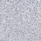 Immunohistochemical staining of human liver shows no positivity in hepatocytes.as expected.