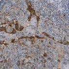 Immunohistochemical staining of human tonsil shows moderate to strong nuclear and cytoplasmic positivity in squamous epithelial cells.