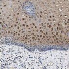 Immunohistochemical staining of human esophagus shows moderate to strong nuclear positivity in squamous epithelial cells.