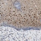 Immunohistochemical staining of human esophagus shows moderate to strong nuclear positivity in squamous epithelial cells.