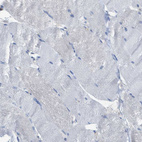 Immunohistochemical staining of human skeletal muscle shows no positivity in myocytes as expected.