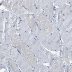 Immunohistochemical staining of human skeletal muscle shows no positivity in myocytes as expected.