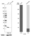 Western blot analysis in human cell lines A-431 and U-251MG using Anti-CSTB antibody. Corresponding CSTB RNA-seq data are presented for the same cell lines. Loading control: Anti-HSP90B1.