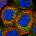 Immunofluorescent staining of human cell line A-431 shows localization to cytosol.