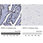 Anti-RSPH1 Antibody