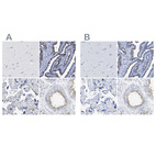 Anti-RSPH1 Antibody