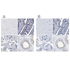 Immunohistochemical staining of human cerebral cortex, fallopian tube, placenta and testis using Anti-RSPH1 antibody HPA017382 (A) shows similar protein distribution across tissues to independent antibody HPA016816 (B).