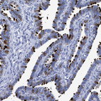 Anti-RSPH1 Antibody