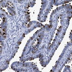 Immunohistochemical staining of human Fallopian tube shows strong positivity in cilia in glandular cells.