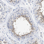 Anti-RSPH1 Antibody