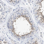Immunohistochemical staining of human testis shows moderate cytoplasmic positivity in cells in seminiferous ducts.