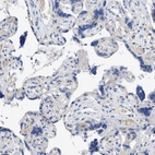 Immunohistochemical staining of human placenta shows no positivity in trophoblastic cells as expected.