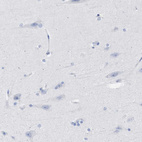 Anti-RSPH1 Antibody