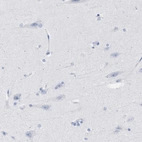 Immunohistochemical staining of human cerebral cortex shows no positivity in neurons as expected.