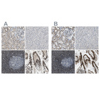 Anti-SP100 Antibody