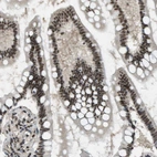 Immunohistochemical staining of human small intestine shows strong nuclear positivity in glandular cells.