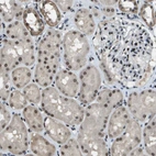 Immunohistochemical staining of human kidney shows moderate nuclear positivity in cells in tubules.