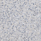 Anti-SP100 Antibody