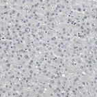 Immunohistochemical staining of human liver shows no positivity in hepatocytes as expected.