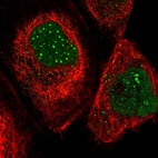 Anti-SP100 Antibody