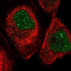 Immunofluorescent staining of human cell line A-431 shows localization to nucleus & nuclear bodies.