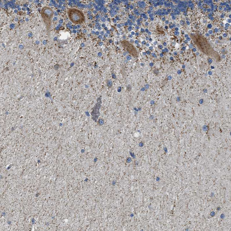 Anti-CAMKK2 Antibody