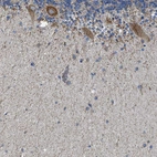 Anti-CAMKK2 Antibody