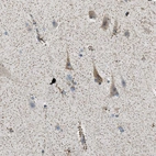 Immunohistochemical staining of human cerebral cortex shows moderate cytoplasmic positivity in neurons.