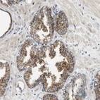 Immunohistochemical staining of human prostate shows moderate cytoplasmic positivity in glandular cells.