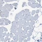 Immunohistochemical staining of human skeletal muscle shows no positivity in myocytes as expected.