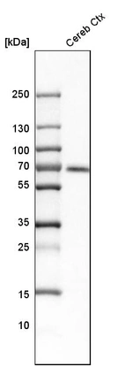 Western blot analysis in human cerebral cortex tissue.