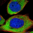 Immunofluorescent staining of human cell line A-431 shows localization to cytosol.