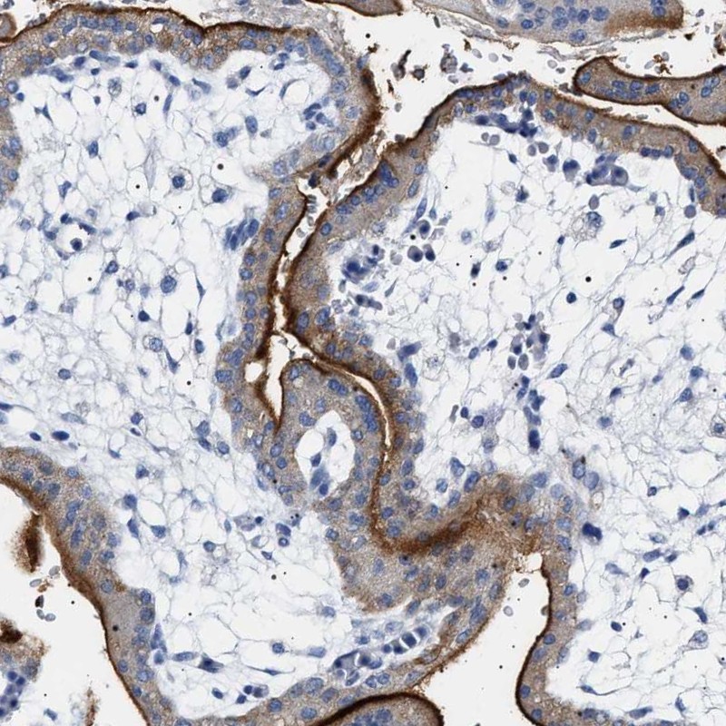 Anti-NAALADL2 Antibody