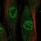 Immunofluorescent staining of human cell line ASC TERT1 shows localization to nucleoplasm.