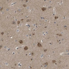 Immunohistochemical staining of human cerebral cortex shows moderate granular cytoplasmic positivity in neurons.