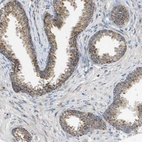 Immunohistochemical staining of human prostate shows moderate granular cytoplasmic positivity in glandular cells.