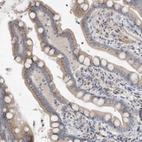 Immunohistochemical staining of human colon shows moderate granular cytoplasmic positivity in glandular cells.