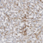 Immunohistochemical staining of human liver shows moderate granular cytoplasmic positivity in hepatocytes.
