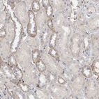 Immunohistochemical staining of human kidney shows moderate granular cytoplasmic positivity in cells in distal tubules.