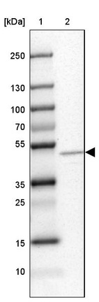 Lane 1: Marker [kDa] 250, 130, 100, 70, 55, 35, 25, 15, 10_br/_Lane 2: Human cell line SK-MEL-30