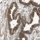 Immunohistochemical staining of human prostate shows strong cytoplasmic positivity in glandular cells.