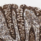 Immunohistochemical staining of human colon shows strong cytoplasmic positivity in glandular cells.