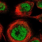 Immunofluorescent staining of human cell line A-431 shows localization to nucleoplasm.