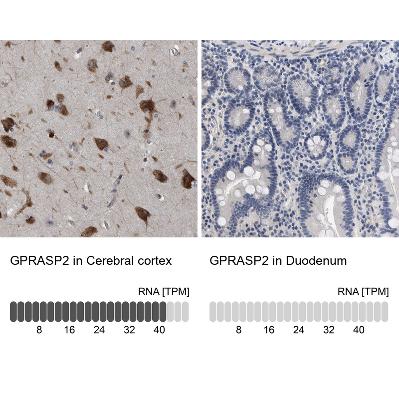 Anti-GPRASP2 Antibody