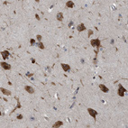 Immunohistochemical staining of human cerebral cortex shows strong cytoplasmic positivity in neurons.