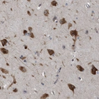 Immunohistochemical staining of human cerebral cortex shows strong cytoplasmic positivity in neurons.