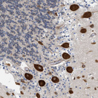 Immunohistochemical staining of human cerebellum shows strong cytoplasmic positivity in Purkinje cells.