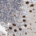 Immunohistochemical staining of human cerebellum shows strong cytoplasmic positivity in Purkinje cells.