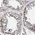 Immunohistochemical staining of human testis shows strong nuclear positivity in a subset of cells in seminiferous ducts.